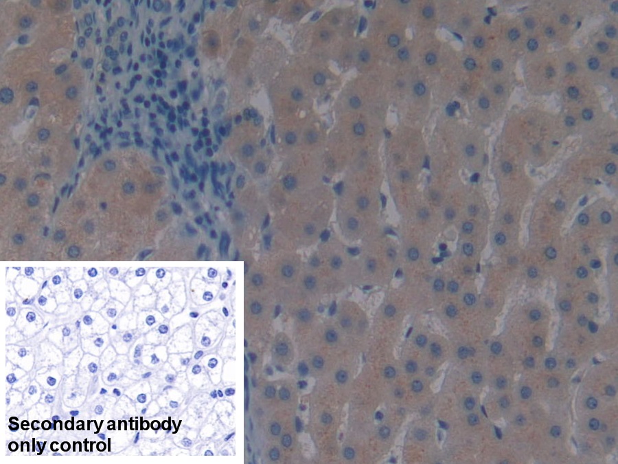 Polyclonal Antibody to Vitamin D Binding Protein (DBP)