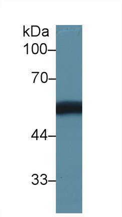 Polyclonal Antibody to Vitamin D Binding Protein (DBP)