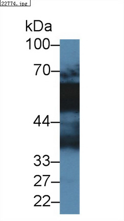 Polyclonal Antibody to Vitamin D Binding Protein (DBP)