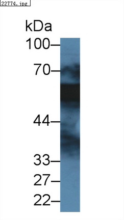 Polyclonal Antibody to Vitamin D Binding Protein (DBP)