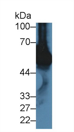 Polyclonal Antibody to Vitamin D Binding Protein (DBP)