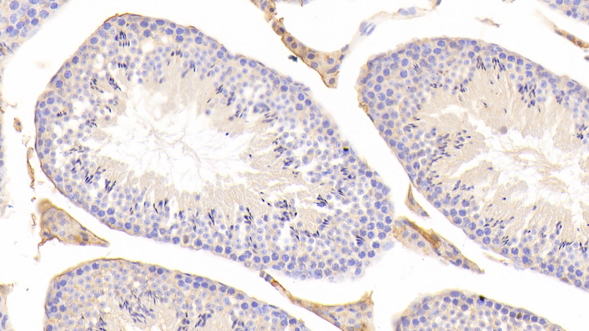 Polyclonal Antibody to Vitamin D Binding Protein (DBP)