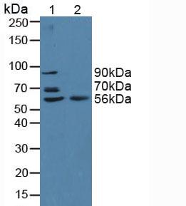 Polyclonal Antibody to Beta Secretase 2 (BACE2)