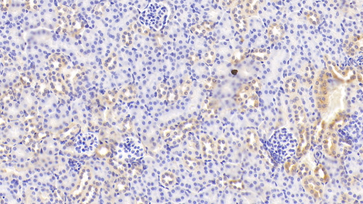 Polyclonal Antibody to Beta Secretase 2 (BACE2)
