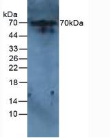 Polyclonal Antibody to Interleukin 6 Receptor (IL6R)