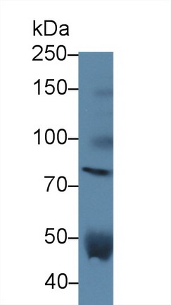 Polyclonal Antibody to Versican (VCAN)