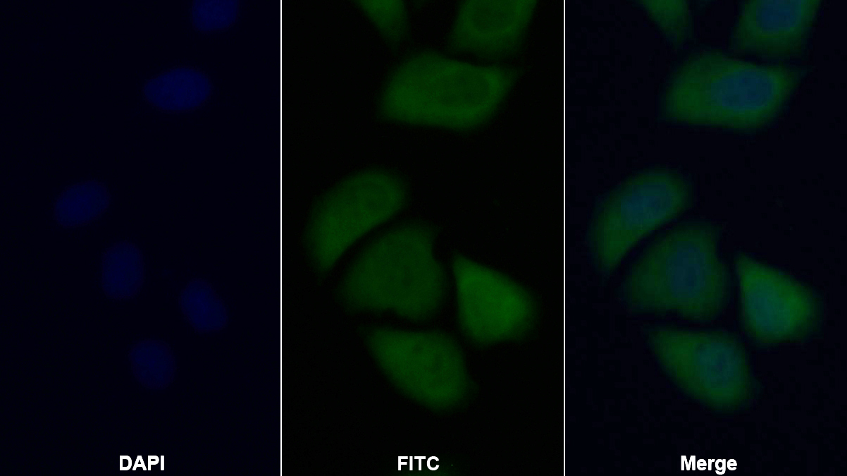 Polyclonal Antibody to Cytokeratin 17 (CK17)