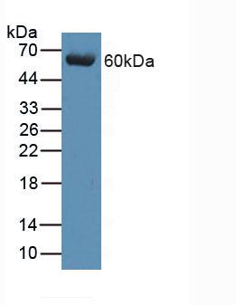 Polyclonal Antibody to Complement Component 9 (C9)