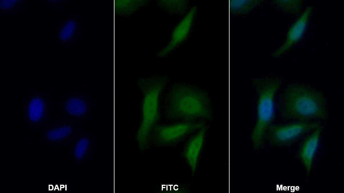 Polyclonal Antibody to Nuclear Factor Kappa B (NFkB)