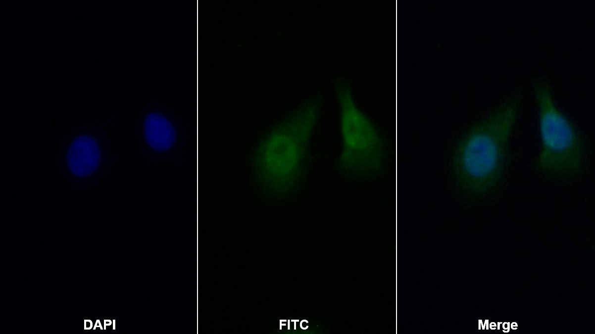 Polyclonal Antibody to Nuclear Factor Kappa B (NFkB)