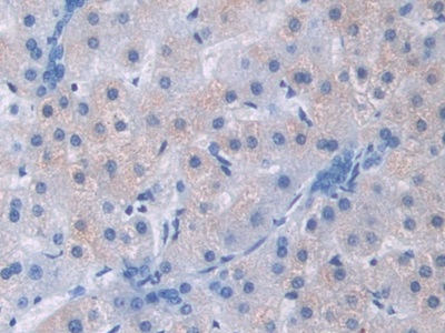Polyclonal Antibody to A Disintegrin And Metalloprotease 9 (ADAM9)