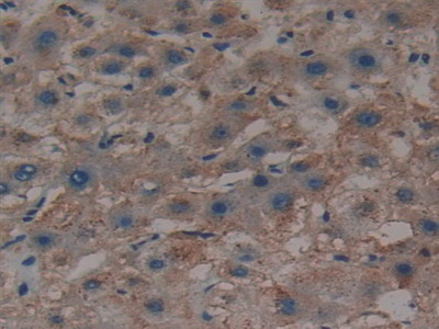 Polyclonal Antibody to Hedgehog Homolog, Sonic (SHH)