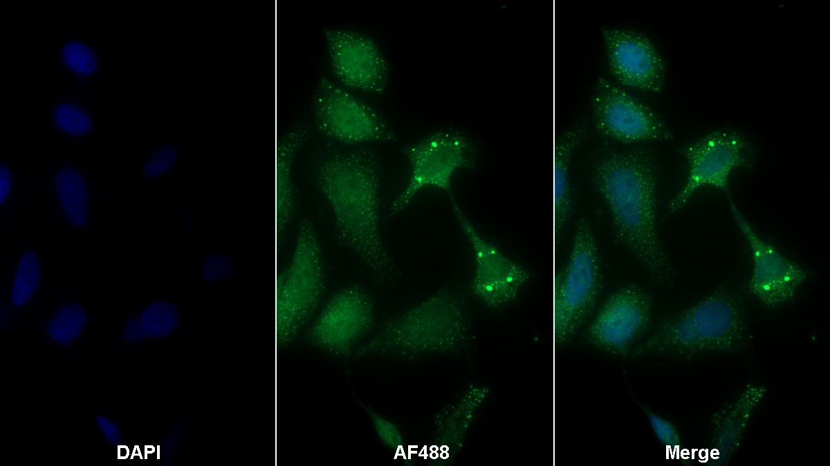 Polyclonal Antibody to Hedgehog Homolog, Sonic (SHH)