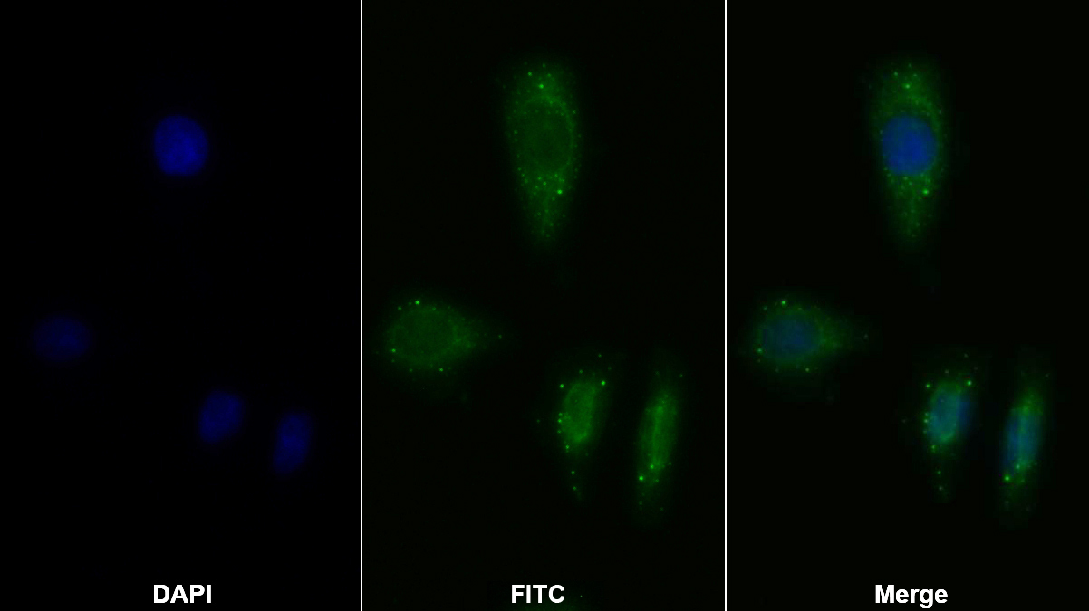 Polyclonal Antibody to Interleukin 2 Receptor Alpha (IL2Ra)