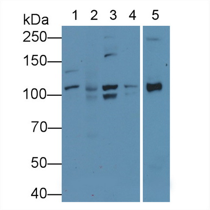 Polyclonal Antibody to Vinculin (VCL)