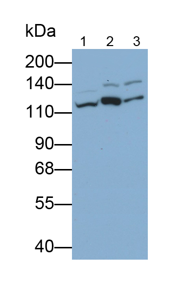 Polyclonal Antibody to Vinculin (VCL)