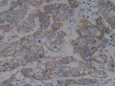 Polyclonal Antibody to Inhibitory Subunit Of NF Kappa B Beta (IkBb)