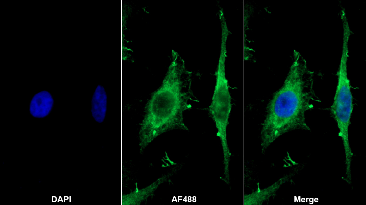 Polyclonal Antibody to Rho Associated Coiled Coil Containing Protein Kinase 2 (Rock2)