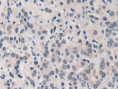 Polyclonal Antibody to Matrix Metalloproteinase 19 (MMP19)