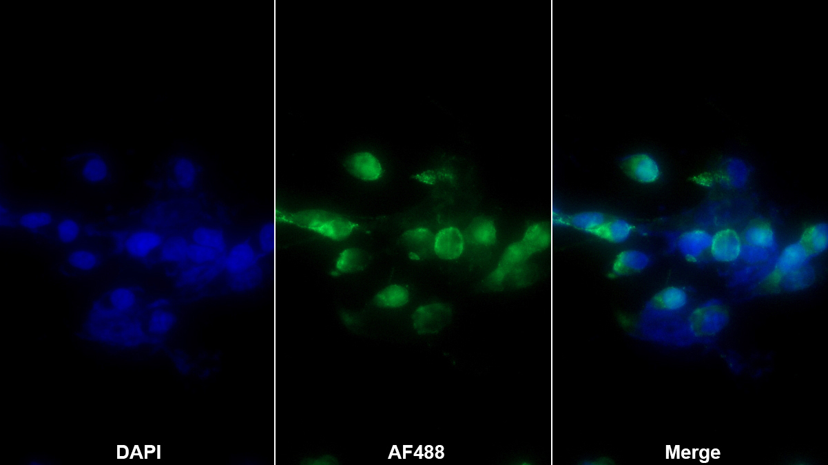 Polyclonal Antibody to Matrix Metalloproteinase 19 (MMP19)