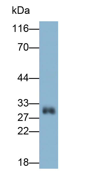 Polyclonal Antibody to Lectin Like Oxidized Low Density Lipoprotein Receptor 1 (LOX1)