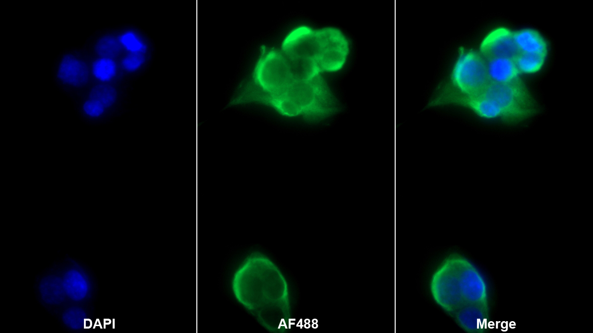 Polyclonal Antibody to Fetuin B (FETUB)
