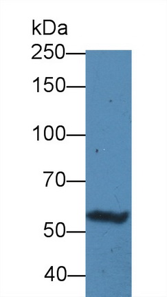 Polyclonal Antibody to Receptor Tyrosine Protein Kinase erbB-2 (ErbB2)