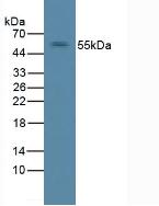 Polyclonal Antibody to Receptor Tyrosine Protein Kinase erbB-2 (ErbB2)