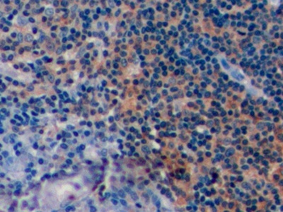 Polyclonal Antibody to Cluster Of Differentiation 19 (CD19)