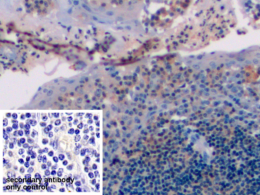 Polyclonal Antibody to Cluster Of Differentiation 19 (CD19)