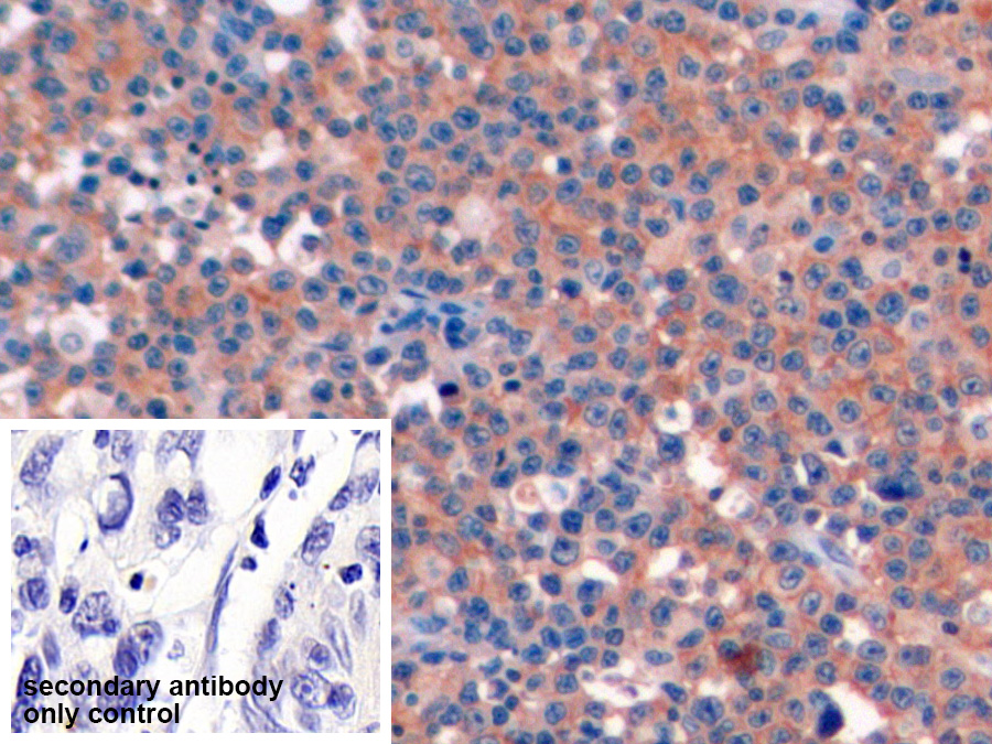 Polyclonal Antibody to Cluster Of Differentiation 19 (CD19)