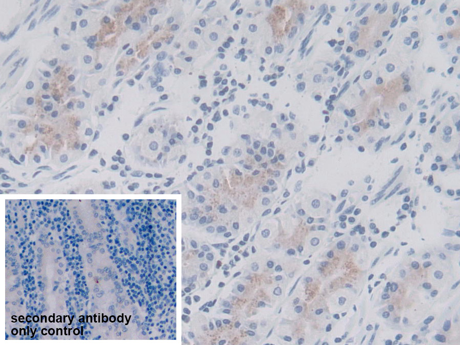 Polyclonal Antibody to Cluster Of Differentiation 19 (CD19)