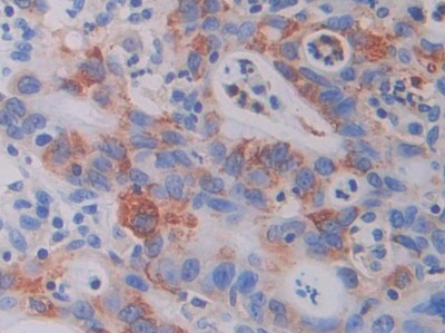 Polyclonal Antibody to Coagulation Factor VII (F7)