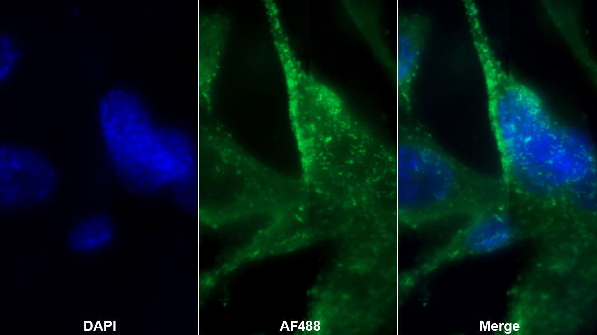 Polyclonal Antibody to Coagulation Factor VII (F7)