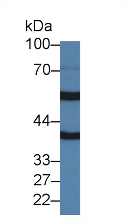 Polyclonal Antibody to Coagulation Factor VII (F7)