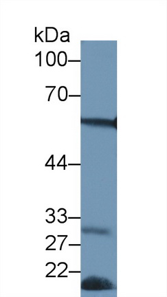 Polyclonal Antibody to Forkhead Box P3 (FOXP3)