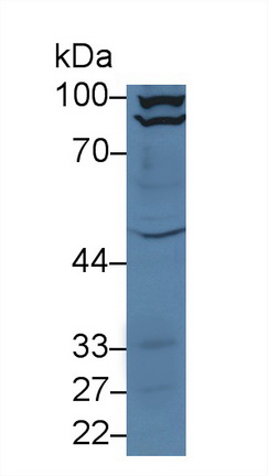 Polyclonal Antibody to Angiotensin I Converting Enzyme 2 (ACE2)