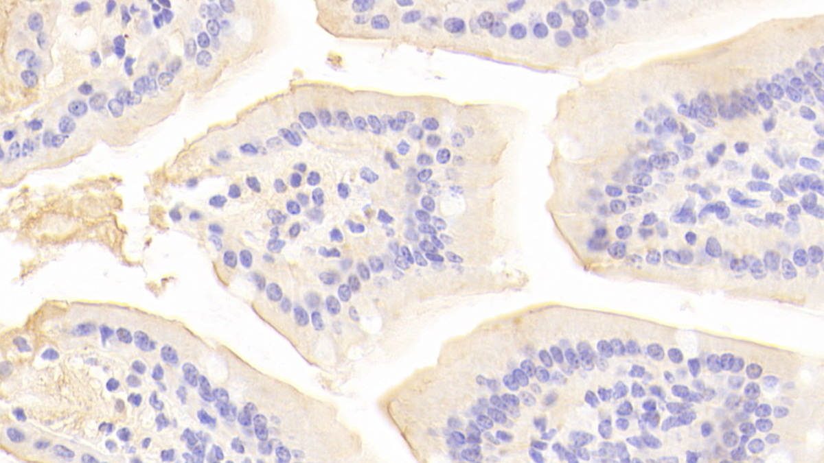 Polyclonal Antibody to Angiotensin I Converting Enzyme 2 (ACE2)