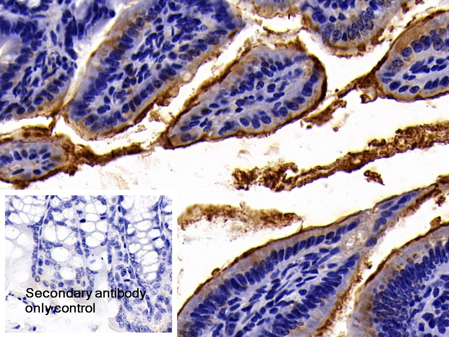 Polyclonal Antibody to Angiotensin I Converting Enzyme 2 (ACE2)