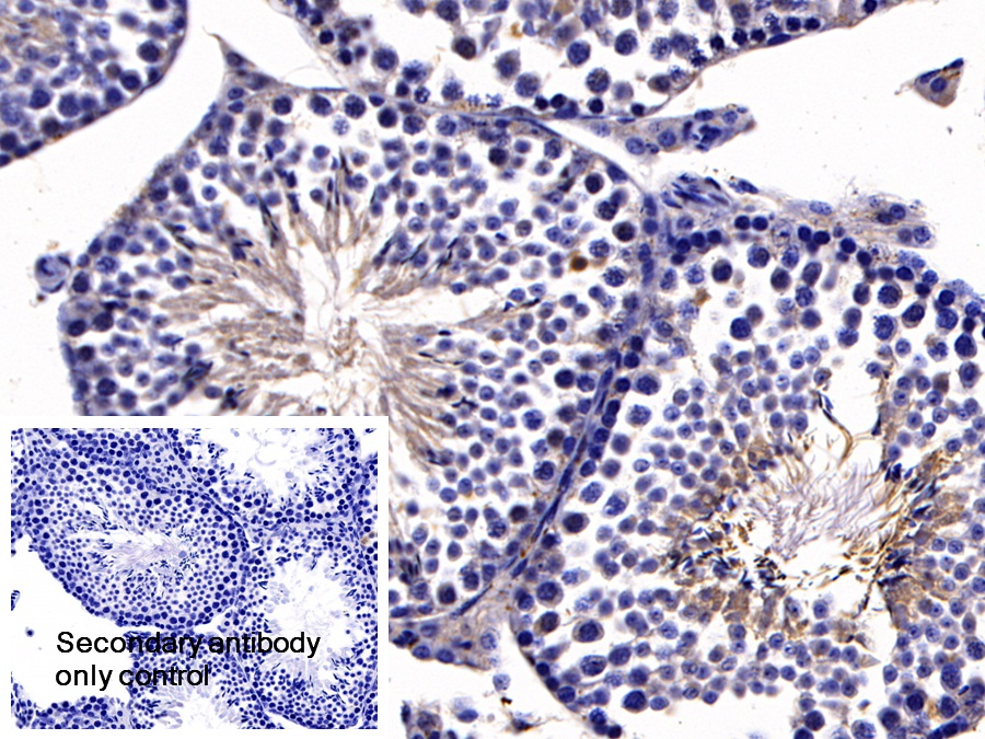 Polyclonal Antibody to Angiotensin I Converting Enzyme 2 (ACE2)