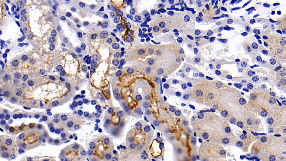 Polyclonal Antibody to Angiotensin I Converting Enzyme 2 (ACE2)