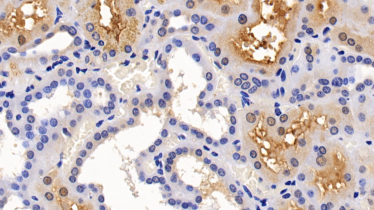 Polyclonal Antibody to Angiotensin I Converting Enzyme 2 (ACE2)