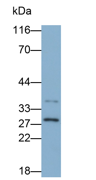 Polyclonal Antibody to Cyclin Dependent Kinase 2 (CDK2)