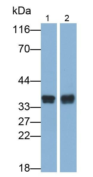 Polyclonal Antibody to Cyclin Dependent Kinase 2 (CDK2)