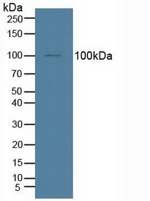 Polyclonal Antibody to Insulin Degrading Enzyme (IDE)