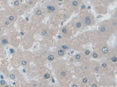 Polyclonal Antibody to Insulin Degrading Enzyme (IDE)