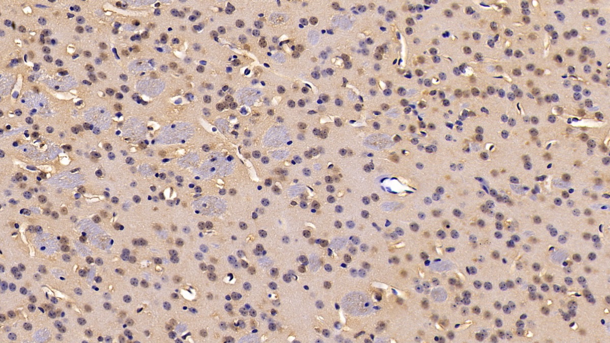 Polyclonal Antibody to Insulin Degrading Enzyme (IDE)