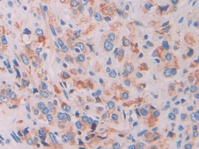 Polyclonal Antibody to Interferon Gamma Inducible Protein 16 (IFI16)