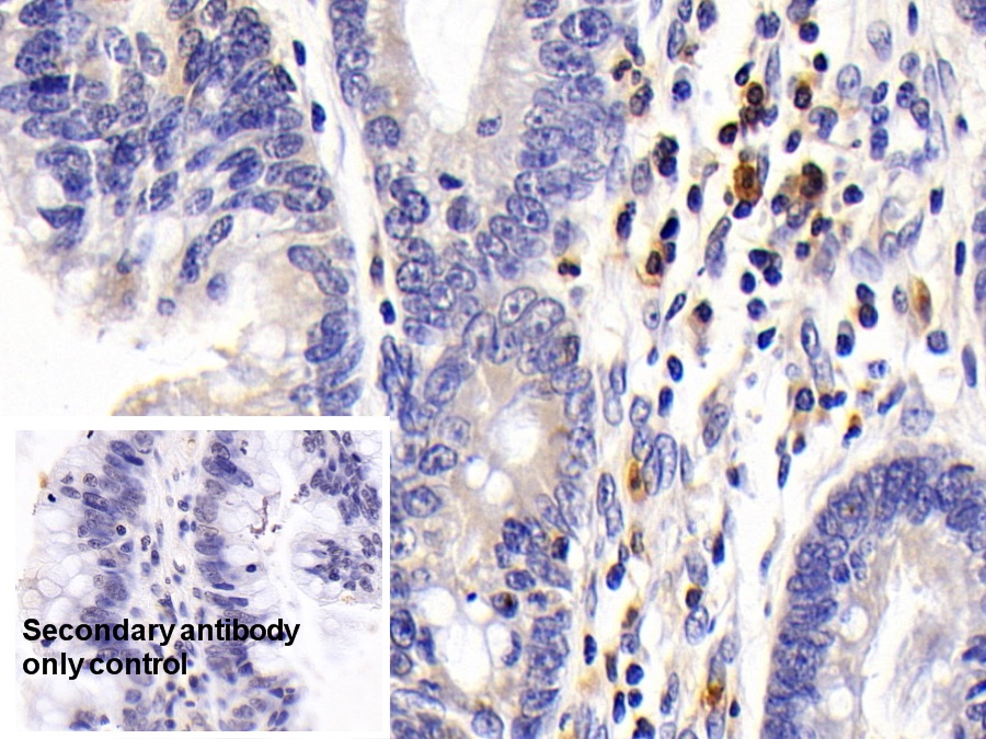 Polyclonal Antibody to Interleukin 7 Receptor (IL7R)