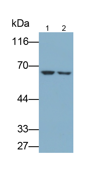 Polyclonal Antibody to Interleukin 7 Receptor (IL7R)